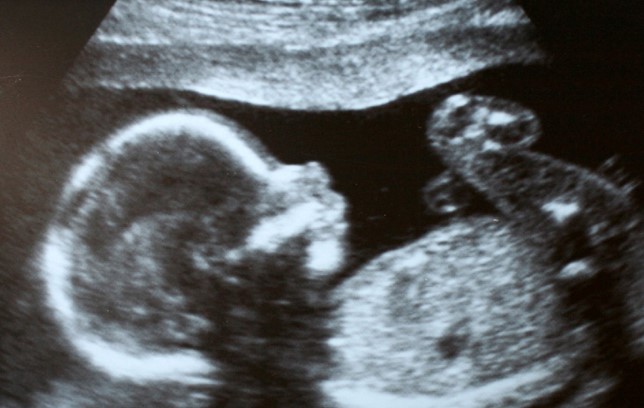 Prenatal photo 1